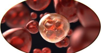 La braquiterapia de alta tasa de dosis es un procedimiento médico especializado para tratar el cáncer, donde se emplea radiación ionizante de manera directa, que actúa eliminando las células cancerígenas evitando que crezcan y se reproduzcan.