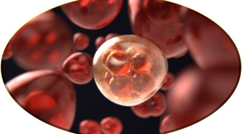 La braquiterapia de alta tasa de dosis es un procedimiento médico especializado para tratar el cáncer, donde se emplea radiación ionizante de manera directa, que actúa eliminando las células cancerígenas evitando que crezcan y se reproduzcan.
