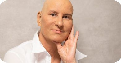La prevención y el control del cáncer se erigen como imperativos fundamentales para mitigar su impacto en la salud pública. En este contexto, los Gemelos Digitales emergen como una herramienta con el potencial de revolucionar la lucha contra esta enfermedad.