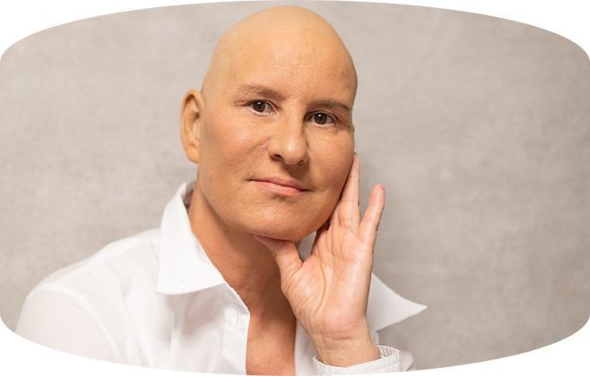 La prevenci&oacute;n y el control del c&aacute;ncer se erigen como imperativos fundamentales para mitigar su impacto en la salud p&uacute;blica. En este contexto, los Gemelos Digitales emergen como una herramienta con el potencial de revolucionar la lucha contra esta enfermedad.