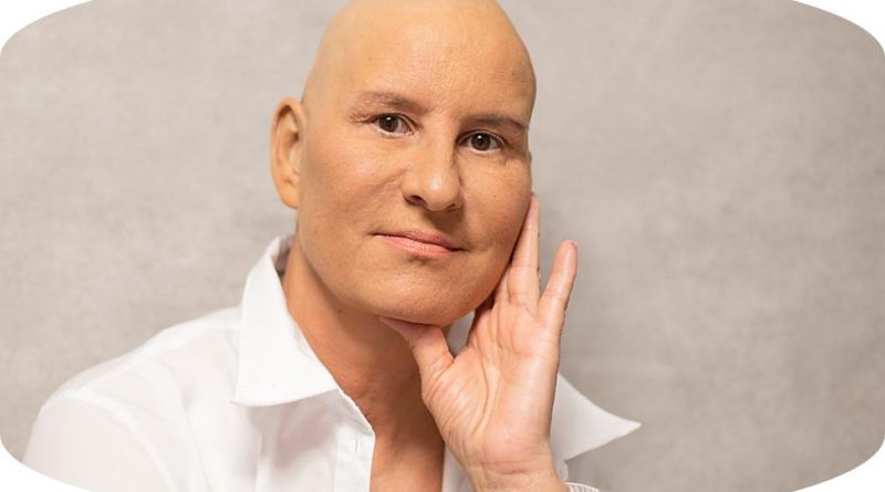 La prevención y el control del cáncer se erigen como imperativos fundamentales para mitigar su impacto en la salud pública. En este contexto, los Gemelos Digitales emergen como una herramienta con el potencial de revolucionar la lucha contra esta enfermedad.